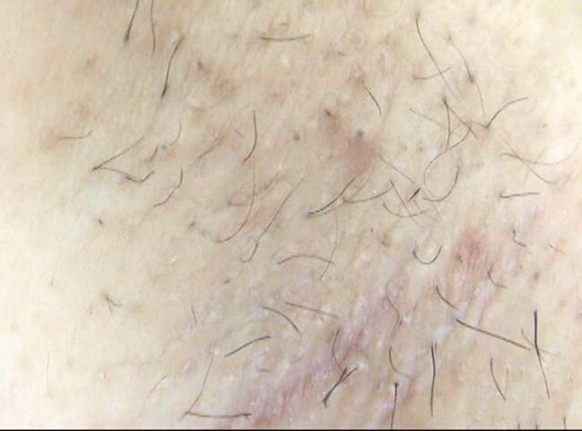 GA-347 パート 6 - 50 分