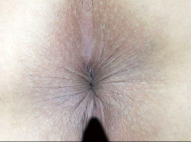 GA-349 パート 14 - 82 分