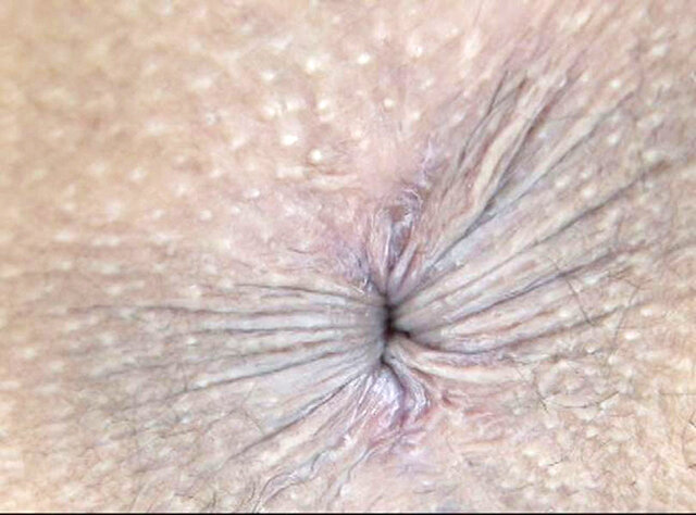 GA-349 Part 2 - 34 minutes