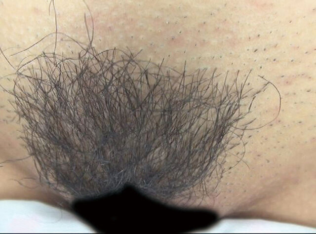 GA-350 Bagian 19 - 102 minit