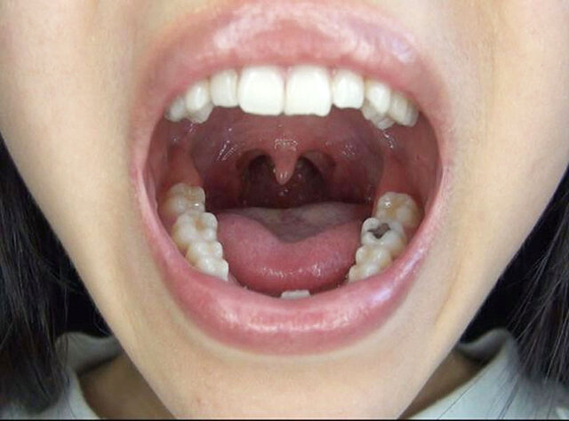 GA-351 Part 11 - 70 minutes