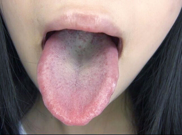 GA-351 Part 14 - 82 minutes