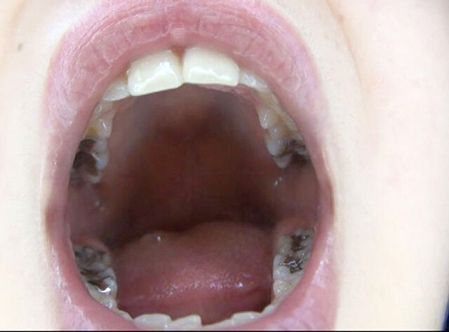 GA-351 パート 15 - 86 分