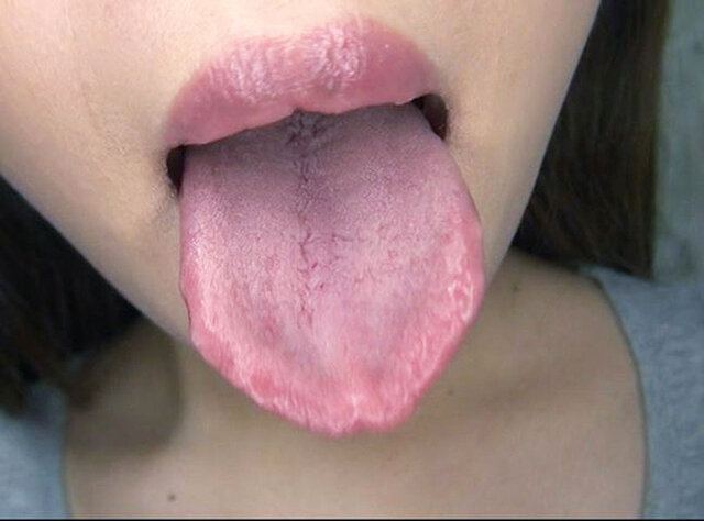 GA-351 Part 17 - 94 minutes