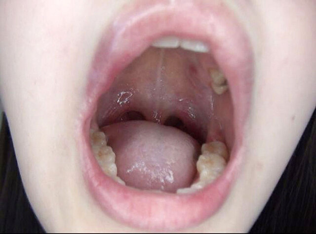 GA-351 Part 19 - 102 minutes