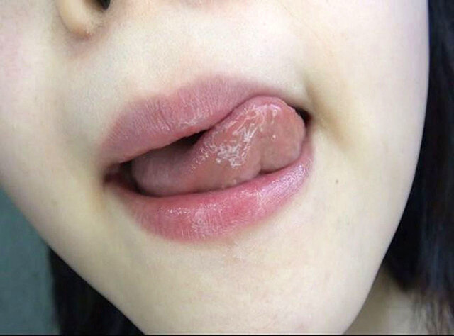 GA-351 Part 20 - 106 minutes