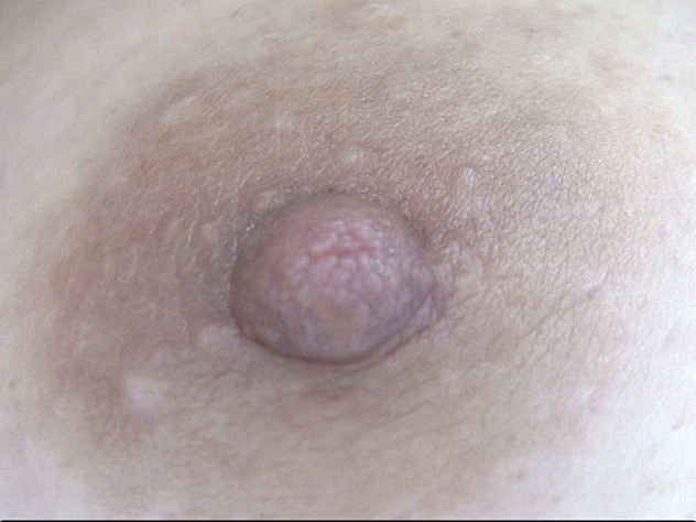 100人の乳首 第8集 15