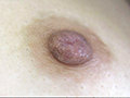 サンプル画像13 - 100人の乳首 第12集