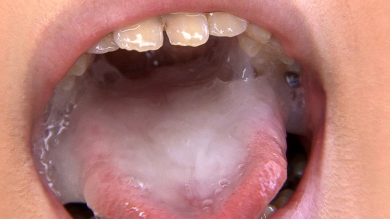 NS-20 パート 8 - 72 分