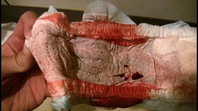 RKS-008 パート 19 - 66 分