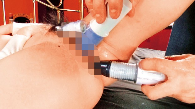 BDSR-418 Bagian 14 - 186 minit