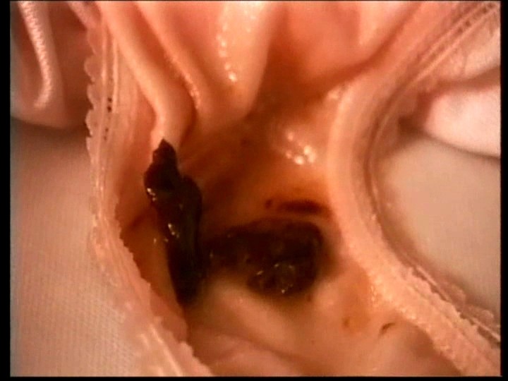 MC-03 第 12 部分 - 52 分钟