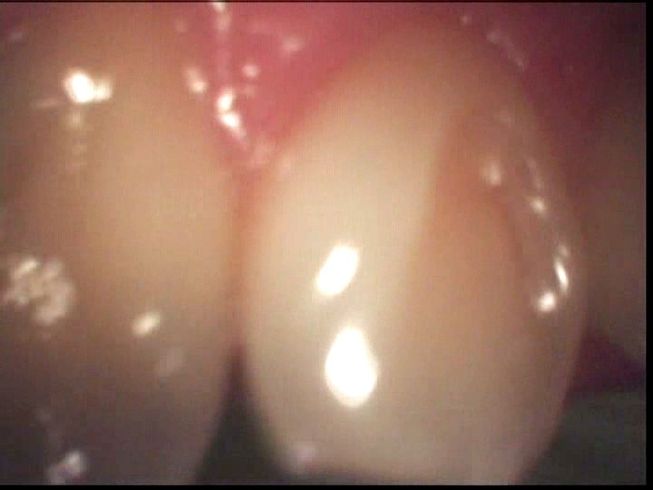 LIA-201 第 8 部分 - 72 分钟