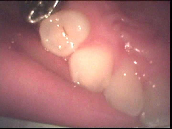 LIA-204 Bagian 9 - 78 minit