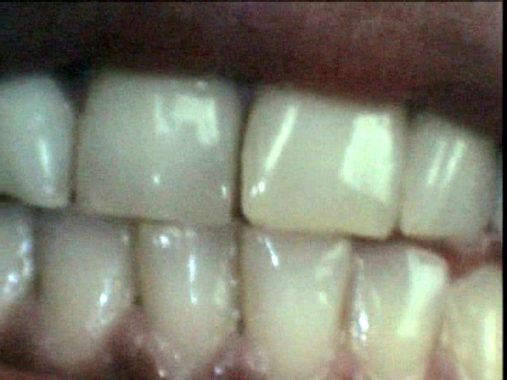 LIA-205 第 11 部分 - 90 分钟