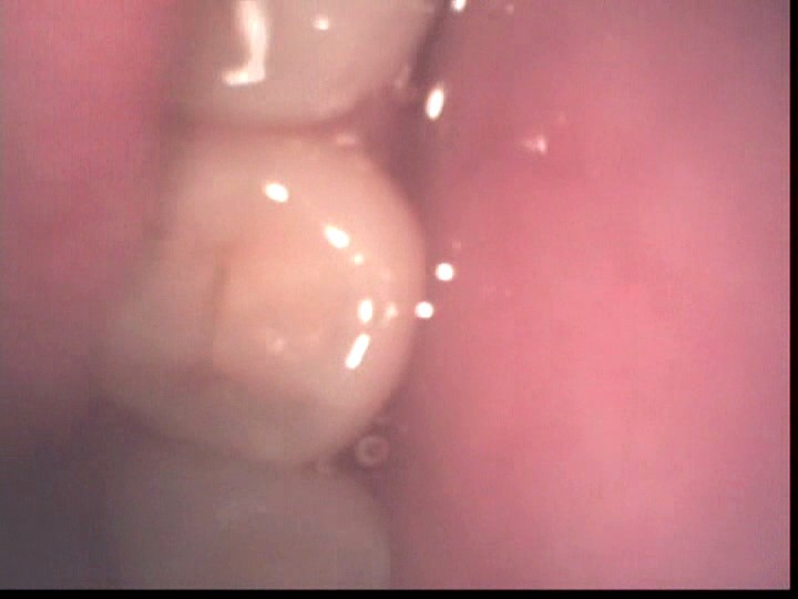 LIA-207 Bagian 15 - 114 minit