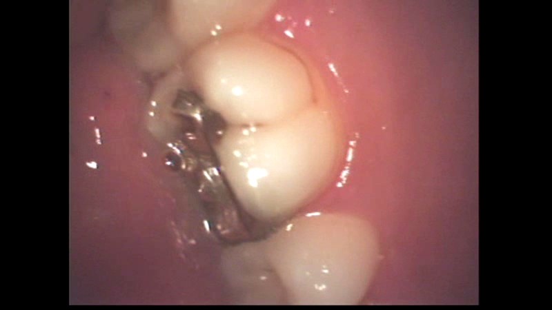 LIA-208 パート 12 - 96 分