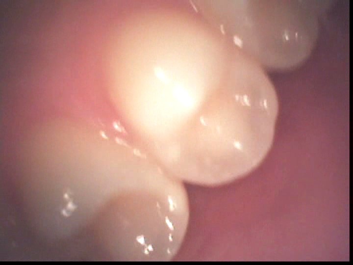 LIA-211 Bagian 17 - 206 minit