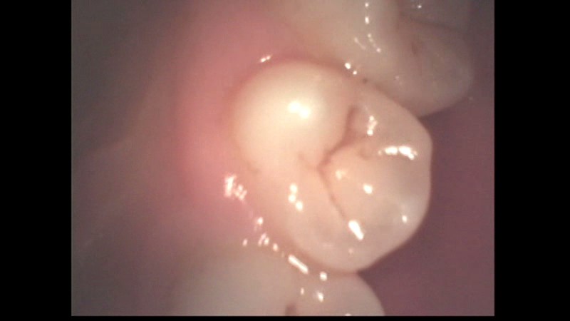 LIA-212 Part 6 - 85 minutes