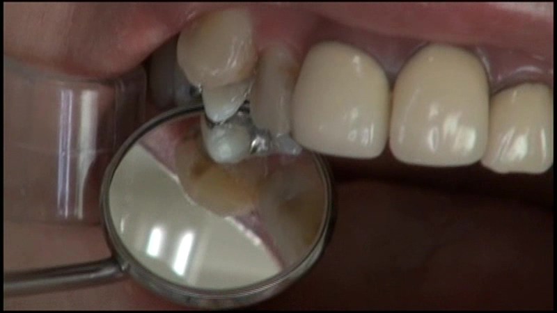 LIA-213 パート 2 - 38 分