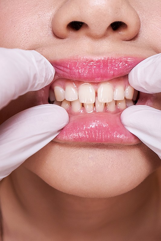 KMVR-932 パート 8 - 79 分