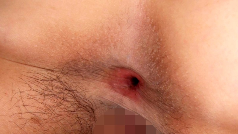 ARM-755 パート 9 - 70 分