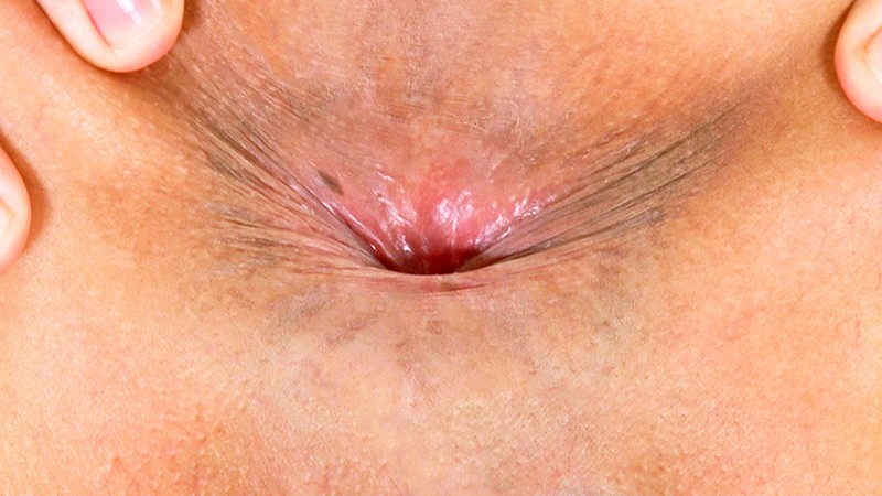 ARM-864 パート 9 - 78 分