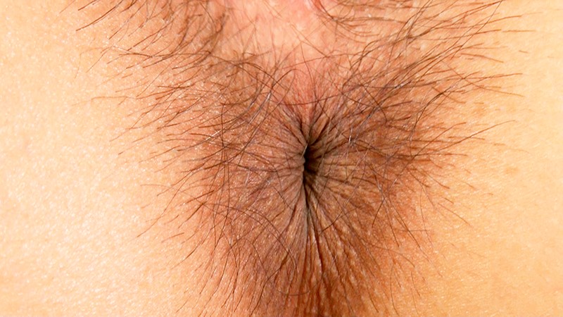 ARM-954 第 9 部分 - 78 分钟