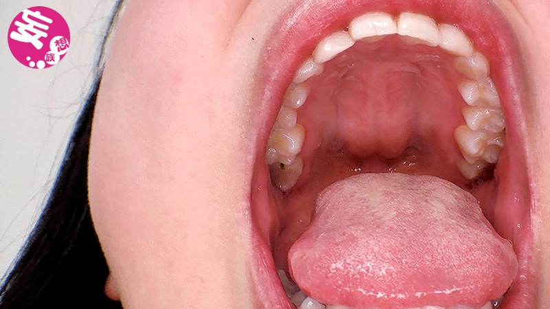 EVIS-155 Bagian 2 - 45 minit