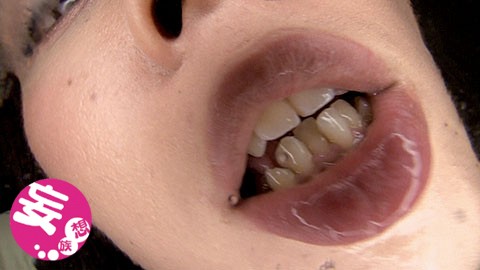 EVIS-177 Part 1 - 30 minutes