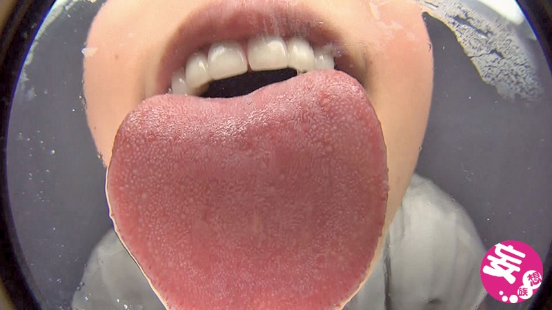 EVIS-249 Bagian 10 - 147 minit