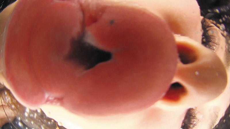 EVIS-282 Part 3 - 50 minutes