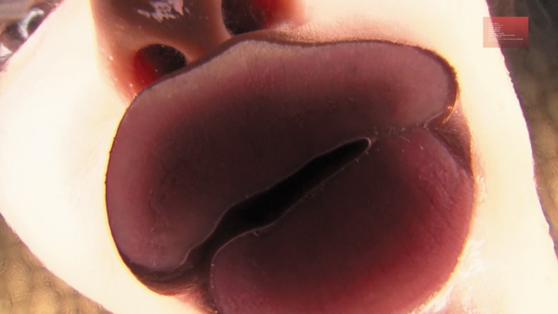 EVIS-303 Bagian 10 - 147 minit