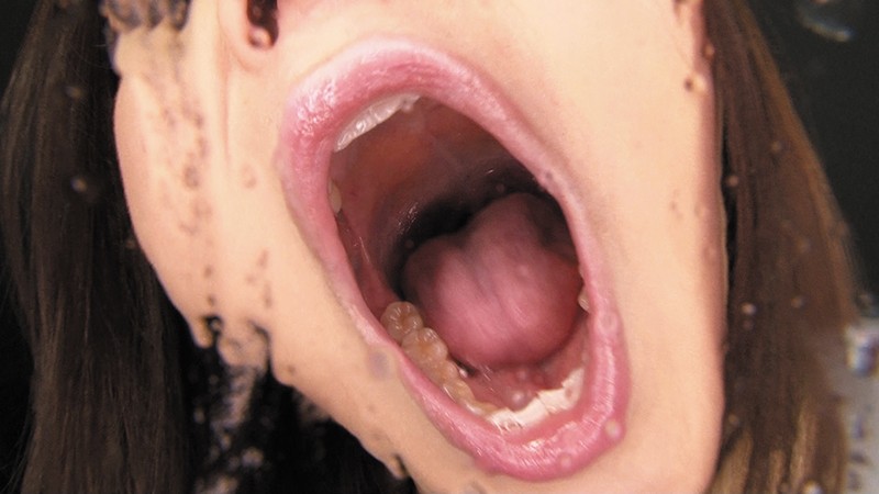 EVIS-303 Bagian 7 - 108 minit