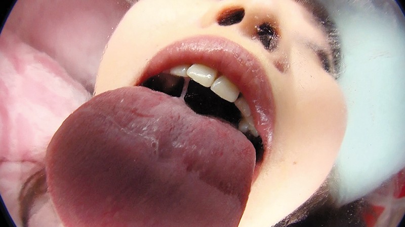 EVIS-307 Part 6 - 100 minutes