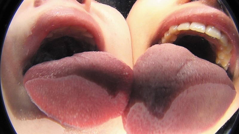 EVIS-323 Bagian 2 - 42 minit