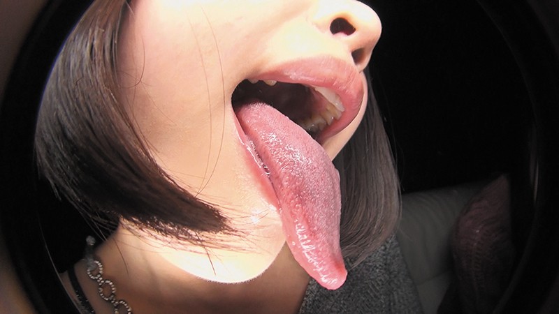 EVIS-323 Bagian 5 - 78 minit