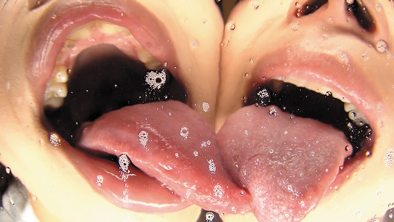 EVIS-340 第 2 部分 - 45 分钟