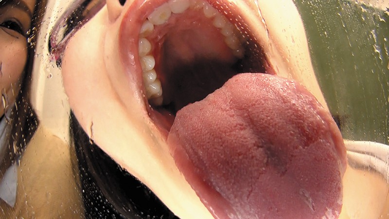 EVIS-340 第 3 部分 - 60 分钟