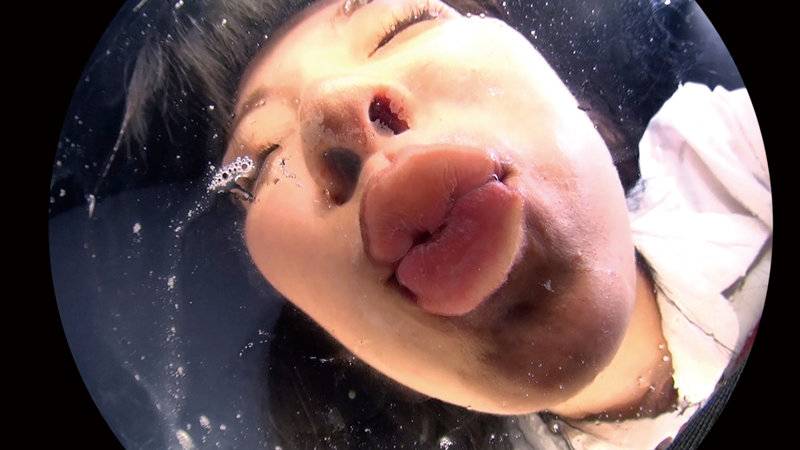 EVIS-402 Bagian 9 - 78 minit