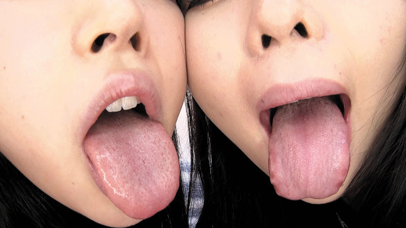 EVIS-414 Bagian 12 - 107 minit