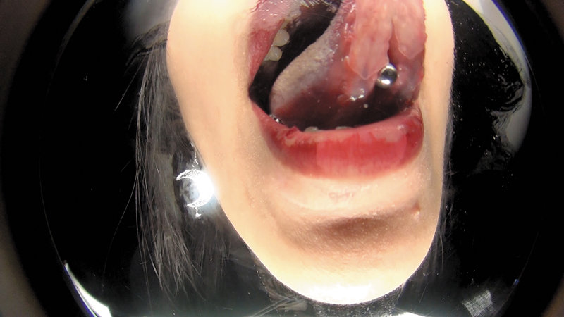 EVIS-419 第 13 部分 - 102 分钟