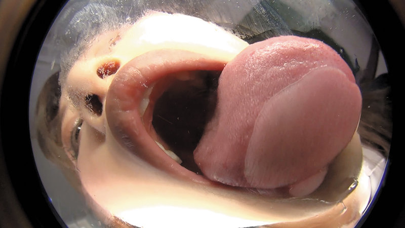 EVIS-419 第 5 部分 - 54 分钟