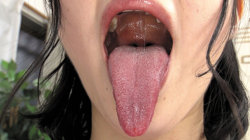 EVIS-444 Bagian 6 - 60 minit