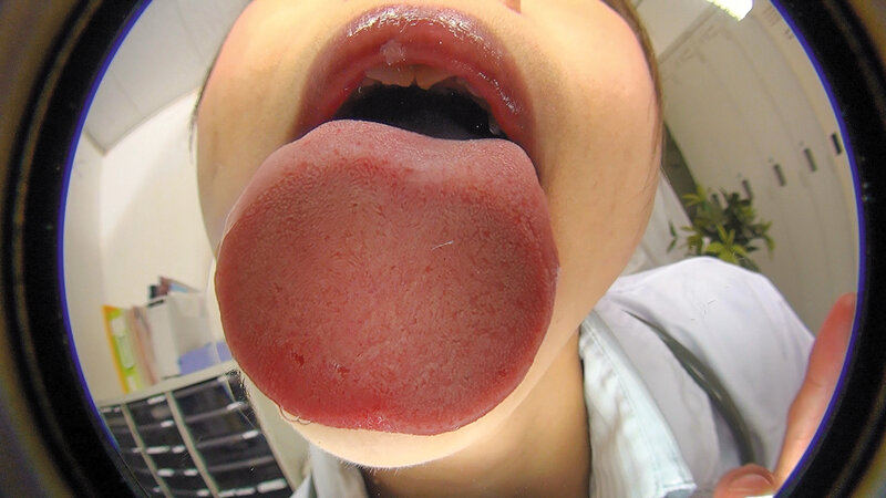 EVIS-450 Bagian 4 - 48 minit