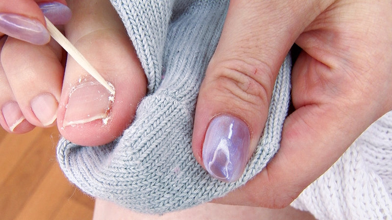 EVIS-461 Bagian 8 - 107 minit