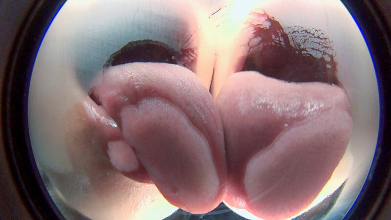 EVIS-482 Part 15 - 114 minutes