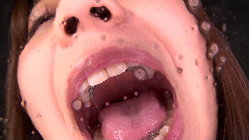 EVIS-490 Bagian 17 - 126 minit