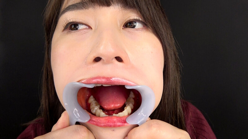 EVIS-501 第 11 部分 - 90 分钟