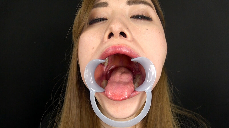 EVIS-501 Bagian 2 - 36 minit